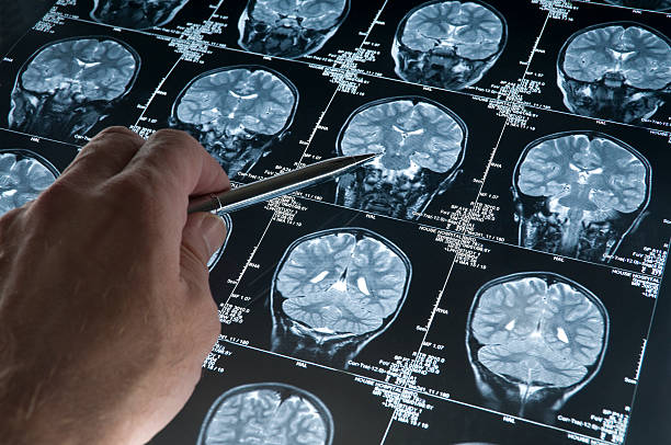 A hand holding a silver stylus points to one of dozens of MRI brain scans on a lightboard.